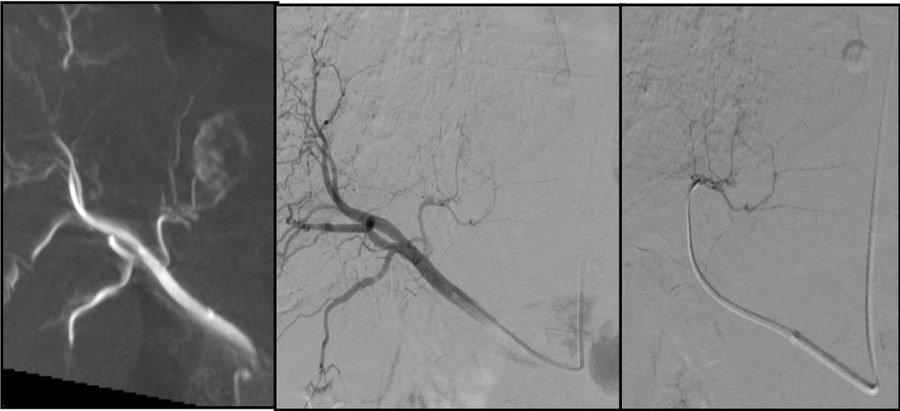 Angiography suite — Interventional Radiology Cochin