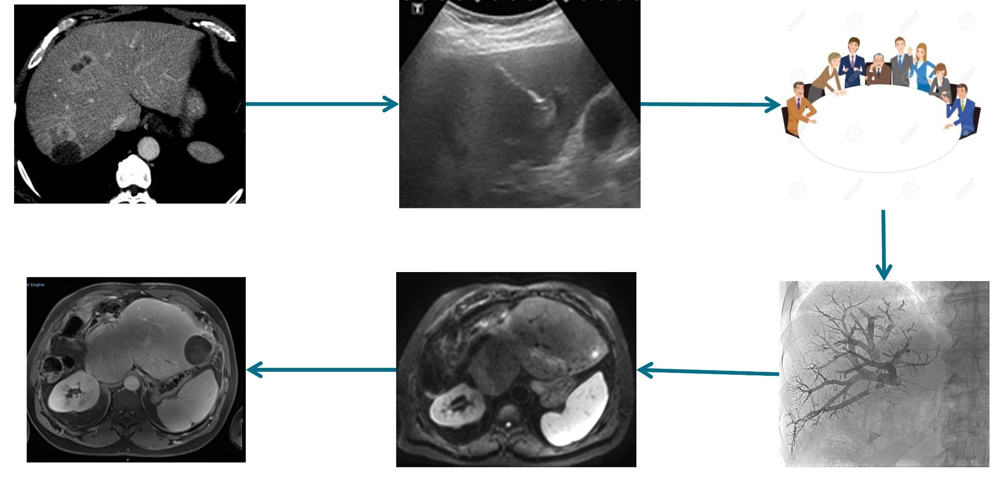 La radiologie interventionnelle : spécialité transversale